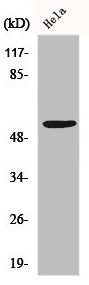Western Blot analysis of COLO205 cells using Fyn Polyclonal Antibody
