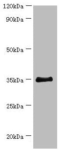 Western blot All lanes: BCAT2 antibody at 14µg/ml + 293T whole cell lysate Secondary Goat polyclonal to rabbit IgG at 1/10000 dilution Predicted band size: 45, 34 kDa Observed band size: 34 kDa