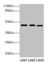 Western blot All lanes: BCAT2 antibody at 2µg/ml Lane 1: NIH/3T3 whole cell lysate Lane 2: Mouse kidney tissue Lane 3: Mouse spleen tissue Secondary Goat polyclonal to rabbit IgG at 1/10000 dilution Predicted band size: 45, 34 kDa Observed band si...