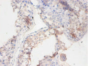 Immunohistochemistry of paraffin-embedded human testis tissue using CSB-PA002604LA01DO at dilution of 1:100
