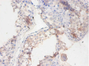 Immunohistochemistry of paraffin-embedded human testis tissue using CSB-PA002604LA01DO at dilution of 1:100