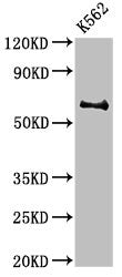 Western Blot Positive WB detected in: K562 whole cell lysate All lanes: BCHE antibody at 3µg/ml Secondary Goat polyclonal to rabbit IgG at 1/50000 dilution Predicted band size: 69 kDa Observed band size: 69 kDa
