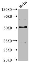 Western Blot Positive WB detected in: Hela whole cell lysate All lanes: BCKDHA antibody at 4.58µg/ml Secondary Goat polyclonal to rabbit IgG at 1/50000 dilution Predicted band size: 51 kDa Observed band size: 51 kDa