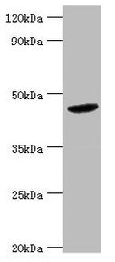 Western blot All lanes: BCKDK antibody at 5µg/ml + Hela whole cell lysate Secondary Goat polyclonal to rabbit IgG at 1/10000 dilution Predicted band size: 47, 38, 42 kDa Observed band size: 47 kDa