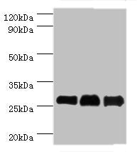 Western blot All lanes: B-cell lymphoma/leukemia 10 antibody at 9ug/ml Lane 1: Mouse gonad tissue Lane 2: MCF-7 whole cell lysate Lane 3: NIH/3T3 whole cell lysate Secondary Goat polyclonal to rabbit IgG at 1/10000 dilution Predicted band size: 26...