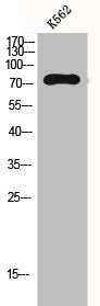 Western Blot analysis of K562 cells using Gab 2 Polyclonal Antibody