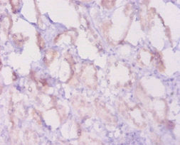Immunohistochemistry of paraffin-embedded human kidney tissue using CSB-PA002611LA01MO at dilution of 1:20