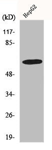 Western Blot analysis of HepG2 cells using GABAA Rα4 Polyclonal Antibody