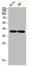 Western Blot analysis of HELA KB cells using GAP-43 Polyclonal Antibody