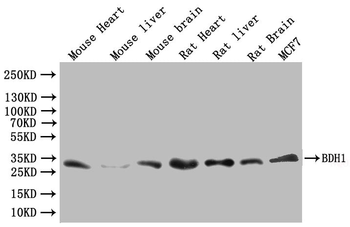Western Blot Positive WB detected in:Mouse Heart tissue lysate, Mouse Liver tissue lysate, Mouse Brain tissue lysate, Rat Heart tissue lysate, Rat Livert tissue lysate, Rat Brain tissue lysate, MCF7 whole cell lysate All lanes: BDH1 antibody at 1:...