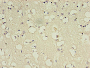 Immunohistochemistry of paraffin-embedded human brain tissue using CSB-PA002655LA01HU at dilution of 1:100