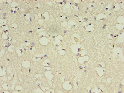 Immunohistochemistry of paraffin-embedded human brain tissue using CSB-PA002655LA01HU at dilution of 1:100