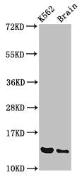 Western Blot Positive WB detected in: K562 whole cell lysate, Rat brain tissue All lanes: BET1 antibody at 3.4µg/ml Secondary Goat polyclonal to rabbit IgG at 1/50000 dilution Predicted band size: 14, 10 kDa Observed band size: 14 kDa