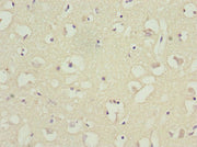 Immunohistochemistry of paraffin-embedded human brain tissue using CSB-PA002678ESR1HU at dilution of 1:100