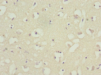 Immunohistochemistry of paraffin-embedded human brain tissue using CSB-PA002678ESR1HU at dilution of 1:100