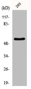 Western Blot analysis of Jurkat cells using GK1 Polyclonal Antibody