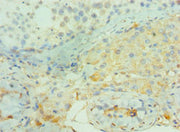 Immunohistochemistry of paraffin-embedded human testis tissue using CSB-PA002700ESR1HU at dilution of 1:100