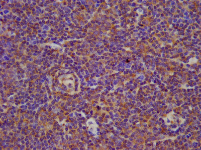 IHC image of CSB-PA002701LA01HU diluted at 1:100 and staining in paraffin-embedded human lymph node tissue performed on a Leica BondTM system. After dewaxing and hydration, antigen retrieval was mediated by high pressure in a citrate buffer (pH 6....