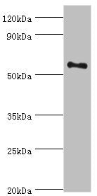 Western blot All lanes: Tyrosine-protein kinase Blk antibody at 10ug/ml + Mouse kidney tissue Secondary Goat polyclonal to rabbit IgG at 1/10000 dilution Predicted band size: 58 kDa Observed band size: 58 kDa