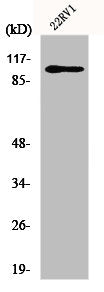Western Blot analysis of 22RV1 cells using GluR-2 Polyclonal Antibody