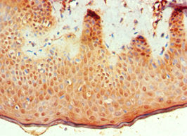 Immunohistochemistry of paraffin-embedded human skin tissue using CSB-PA002735ESR1HU at dilution of 1:100