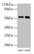 Western blot All lanes: BMP3 antibody at 2µg/ml Lane 1: SW1990 whole cell lysate Lane 2: 293T whole cell lysate Secondary Goat polyclonal to rabbit IgG at 1/10000 dilution Predicted band size: 54 kDa Observed band size: 54 kDa