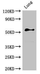 Western Blot Positive WB detected in: Rat lung tissue All lanes: BMPR1B antibody at 2.4ug/ml Secondary Goat polyclonal to rabbit IgG at 1/50000 dilution Predicted band size: 57, 61 kDa Observed band size: 57 kDa