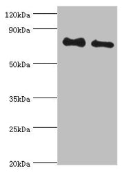 Western blot All lanes: Cytoplasmic tyrosine-protein kinase BMX antibody at 4ug/ml Lane 1: A549 whole cell lysate Lane 2: Mouse heart tissue Secondary Goat polyclonal to rabbit IgG at 1/10000 dilution Predicted band size: 78 kDa Observed band size...