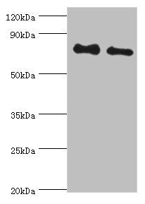 Western blot All lanes: Cytoplasmic tyrosine-protein kinase BMX antibody at 4ug/ml Lane 1: A549 whole cell lysate Lane 2: Mouse heart tissue Secondary Goat polyclonal to rabbit IgG at 1/10000 dilution Predicted band size: 78 kDa Observed band size...