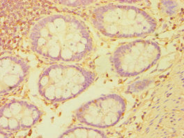 Immunohistochemistry of paraffin-embedded human colon tissue using CSB-PA002761ESR2HU at dilution of 1:100