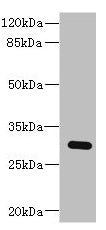 Western blot All lanes: BPGM antibody at 2.87µg/ml + Human placenta tissue Secondary Goat polyclonal to rabbit IgG at 1/10000 dilution Predicted band size: 30 kDa Observed band size: 30 kDa