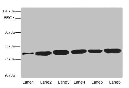 Western blot All lanes: BPGM antibody at 5.94µg/ml Lane 1: Human peripheral blood mononuclear cells Lane 2: Mouse liver tissue Lane 3: Human placenta tissue Lane 4: Hela whole cell lysate Lane 5: 293T whole cell lysate Lane 6: A549 whole cell lysa...