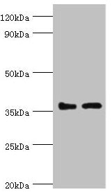 Western blot All lanes: BRCC3 antibody at 3ug/ml Lane 1: 293T whole cell lysate Lane 2: MCF-7 whole cell lysate Secondary Goat polyclonal to rabbit IgG at 1/10000 dilution Predicted band size: 37, 34, 24, 29 kDa Observed band size: 37 kDa