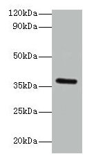 Western blot All lanes: BRCC3 antibody at 2µg/ml + K562 whole cell lysate Secondary Goat polyclonal to rabbit IgG at 1/15000 dilution Predicted band size: 37, 34, 24, 29 kDa Observed band size: 37 kDa