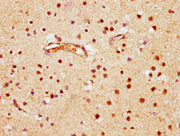IHC image of CSB-PA002799LA01HU diluted at 1:600 and staining in paraffin-embedded human brain tissue performed on a Leica BondTM system. After dewaxing and hydration, antigen retrieval was mediated by high pressure in a citrate buffer (pH 6.0). S...