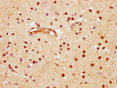 IHC image of CSB-PA002799LA01HU diluted at 1:600 and staining in paraffin-embedded human brain tissue performed on a Leica BondTM system. After dewaxing and hydration, antigen retrieval was mediated by high pressure in a citrate buffer (pH 6.0). S...