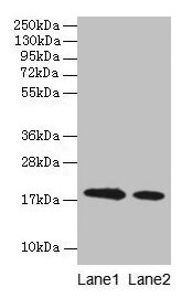 Western blot All lanes: Bovine milk Beta-lactoglobulin antibody at 1:500 Lane 1: Bovine milk Beta-lactoglobulin at 0.1mg/ml Lane 2: Bovine milk Beta-lactoglobulin at 10µg/ml Secondary Goat polyclonal to rabbit IgG at 1/15000 dilution Predicted ban...