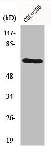 Western Blot analysis of COLO205 cells using GRK 1 Polyclonal Antibody