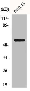 Western Blot analysis of HeLa cells using GRK 7 Polyclonal Antibody