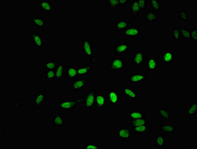 Immunofluorescent analysis of Hela cells using CSB-PA002839LA01HU at dilution of 1:100 and Alexa Fluor 488-congugated AffiniPure Goat Anti-Rabbit IgG(H+L)
