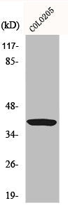Western Blot analysis of COLO205 cells using Gα t1 Polyclonal Antibody