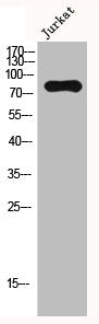 Western Blot analysis of Jurkat cells using HBO1 Polyclonal Antibody