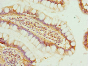 Immunohistochemistry of paraffin-embedded human small intestine tissue using CSB-PA002863ESR1HU at dilution of 1:100