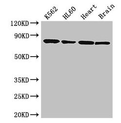 Western Blot Positive WB detected in: K562 whole cell lysate, HL60 whole cell lysate, Mouse heart tissue, Mouse brain tissue All lanes: BTK antibody at 3.5µg/ml Secondary Goat polyclonal to rabbit IgG at 1/50000 dilution Predicted band size: 77, 8...