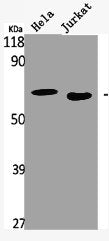 Western Blot analysis of Jurkat HELA cells using Hck Polyclonal Antibody