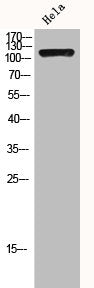 Western Blot analysis of HELA cells using HDAC4 Polyclonal Antibody