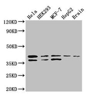 Western Blot Positive WB detected in: Hela whole cell lysate, HEK293 whole cell lysate, MCF-7 whole cell lysate, HepG2 whole cell lysate, Mouse brain tissue All lanes: BUB3 antibody at 3.4ug/ml Secondary Goat polyclonal to rabbit IgG at 1/50000 di...