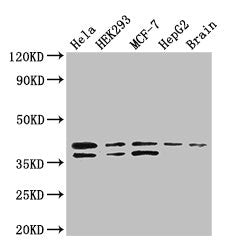 Western Blot Positive WB detected in: Hela whole cell lysate, HEK293 whole cell lysate, MCF-7 whole cell lysate, HepG2 whole cell lysate, Mouse brain tissue All lanes: BUB3 antibody at 3.4ug/ml Secondary Goat polyclonal to rabbit IgG at 1/50000 di...