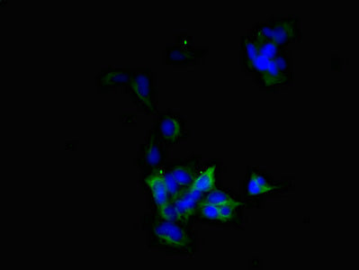 Immunofluorescent analysis of 293 cells using CSB-PA002887ESR1HU at dilution of 1:100 and Alexa Fluor 488-congugated AffiniPure Goat Anti-Rabbit IgG(H+L)