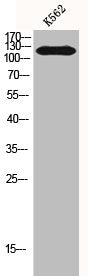 Western Blot analysis of K562 cells using HDAC5 Polyclonal Antibody